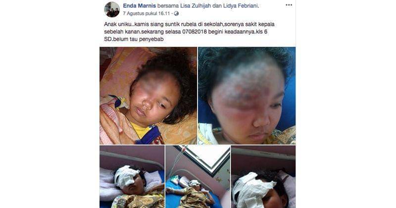 Facebook.com/Enda Marnis