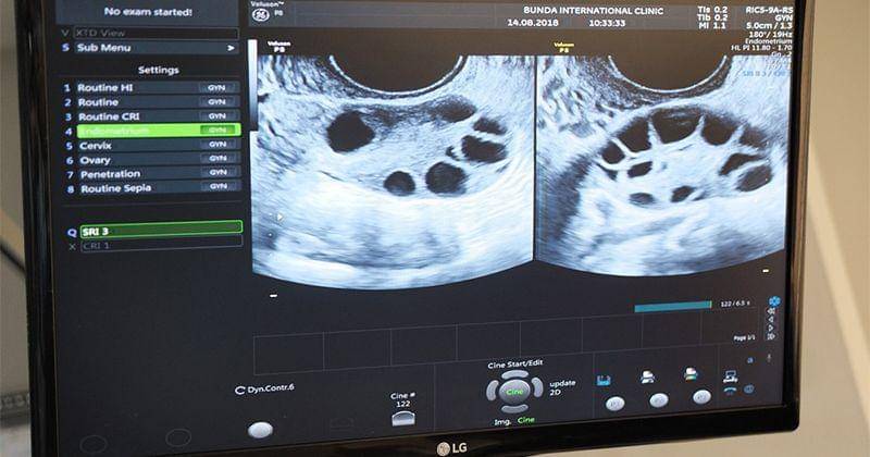 Instagram.com/tya_ariestya