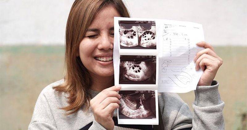 Instagram.com/tya_ariestya