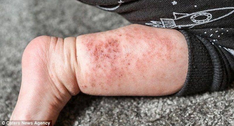 Daily Mail/Caters News Agency