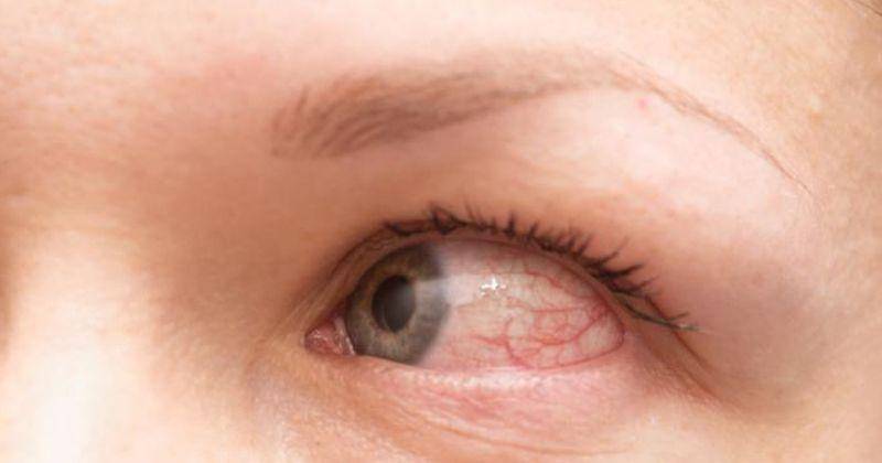 medicalnewstoday.com