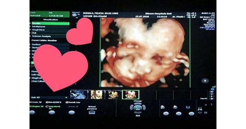 Instagram.com/pandasuper