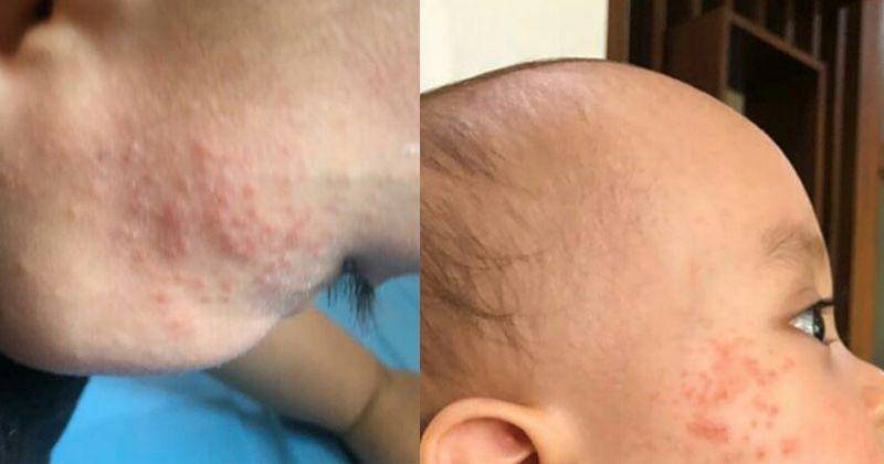 Instagram.com/rachelvennya