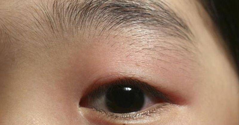 centerforeyecare.com