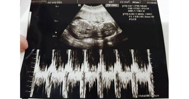 Instagram.com/vatemat