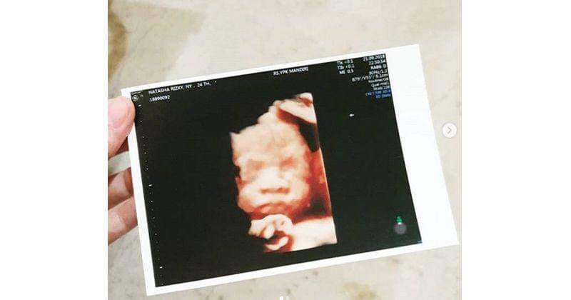 Instagram.com/natasharizkynew