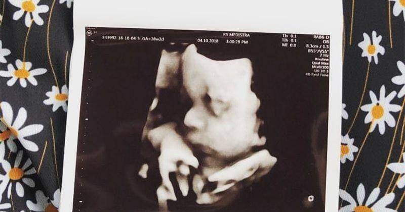 Instagram.com/petra_sihombing