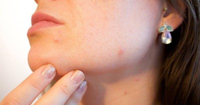 Pixabay/Kjerstin_Michaela