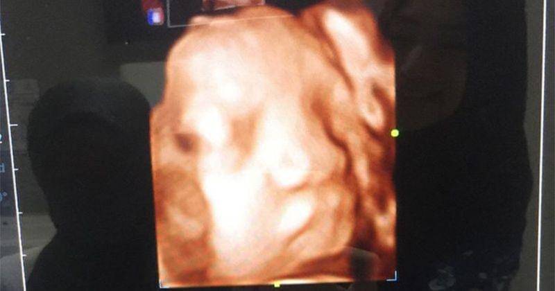 Instagram.com/ustadzabdulsomad