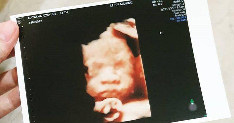 Instagram.com/natasharizkynew