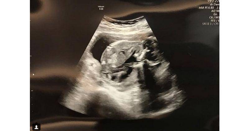 Instagram.com/aryanifitriana24