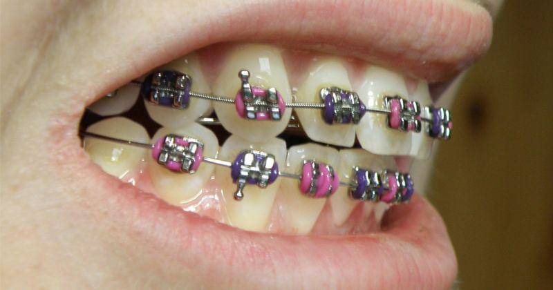 Commons.wikimedia.org