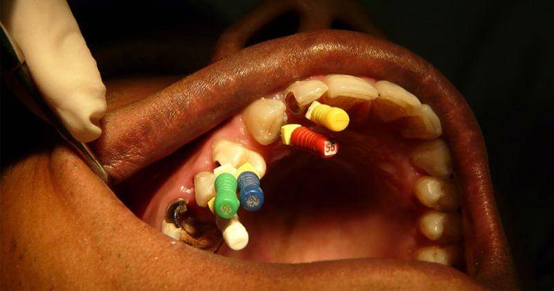 Flickr.com/dr. partha sarathi sahana