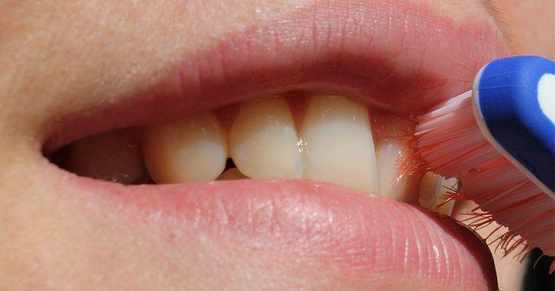 Pixabay/albanycolley