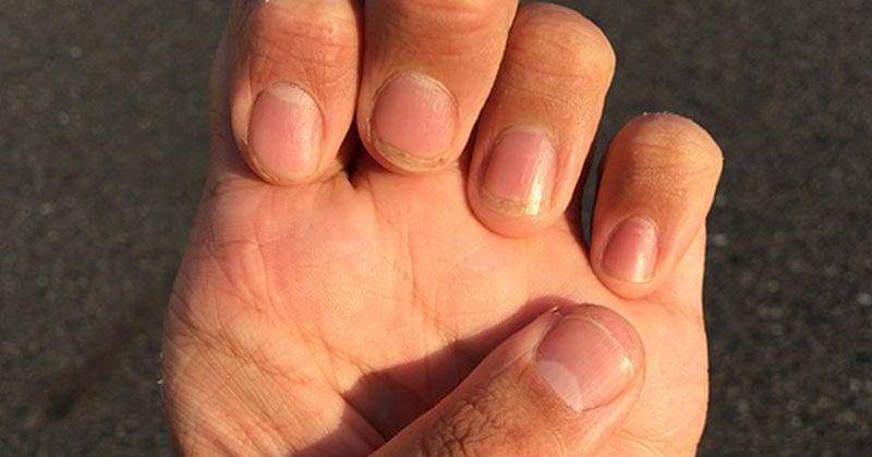 pixabay.com/HNDPTESBC