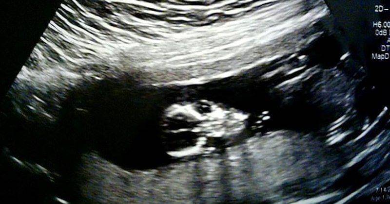 Dailymail.co.uk/Loni Osborne