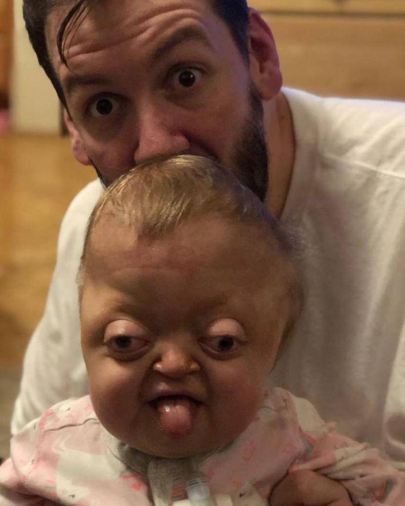 Facebook.com/emerson the unicorn