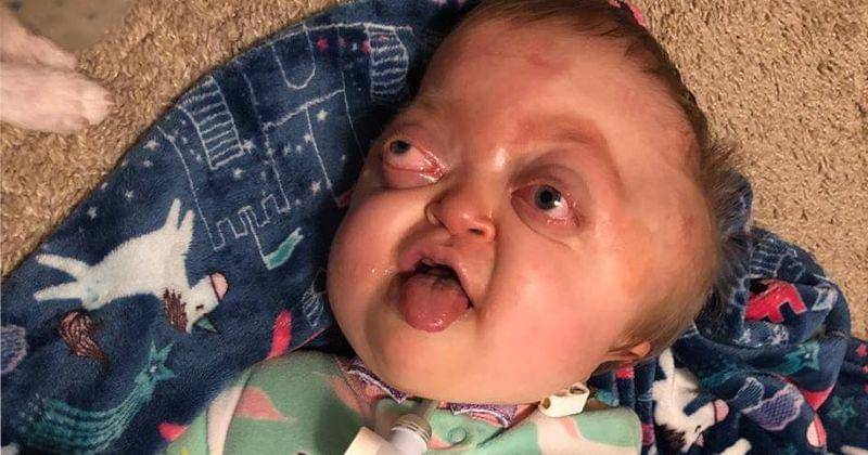 Facebook.com/emerson the unicorn