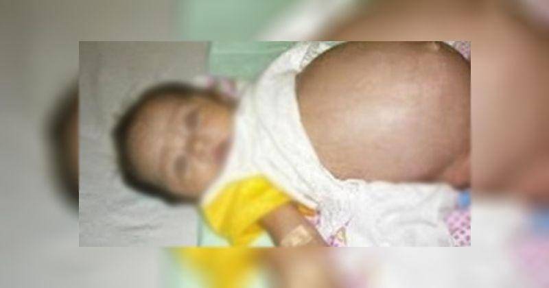 Ilustrasi - Dok. Istimewa