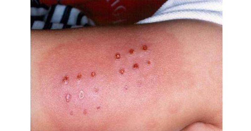 Commons.wikimedia.org