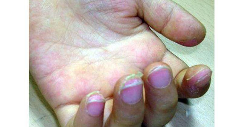 Commons.wikimedia.org