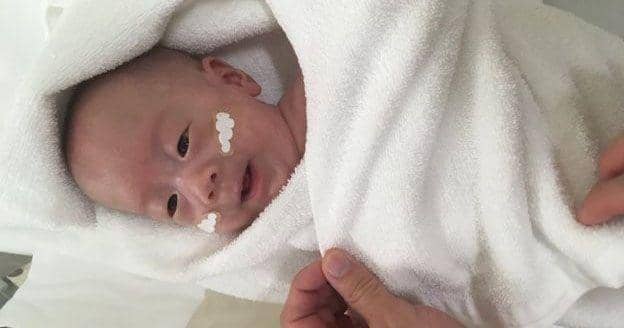 Wow! Bayi Paling Kecil Sedunia Lahir 268 Gram, Selamat dan Sehat!