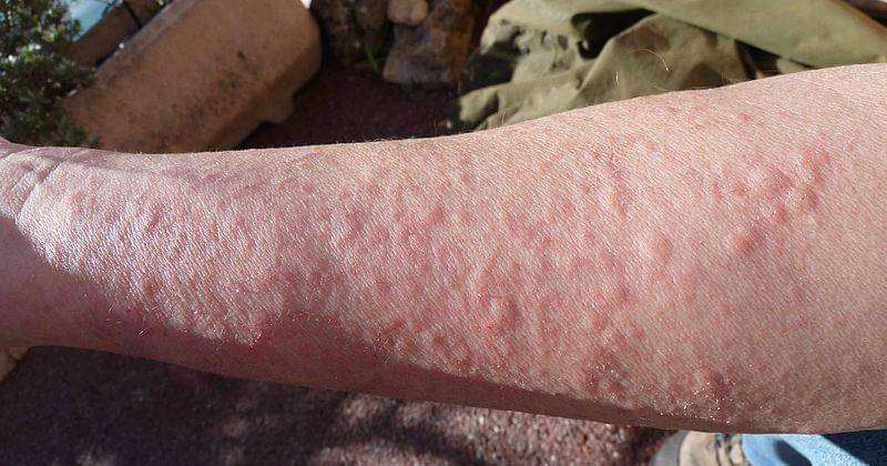 Commons.wikimedia.org