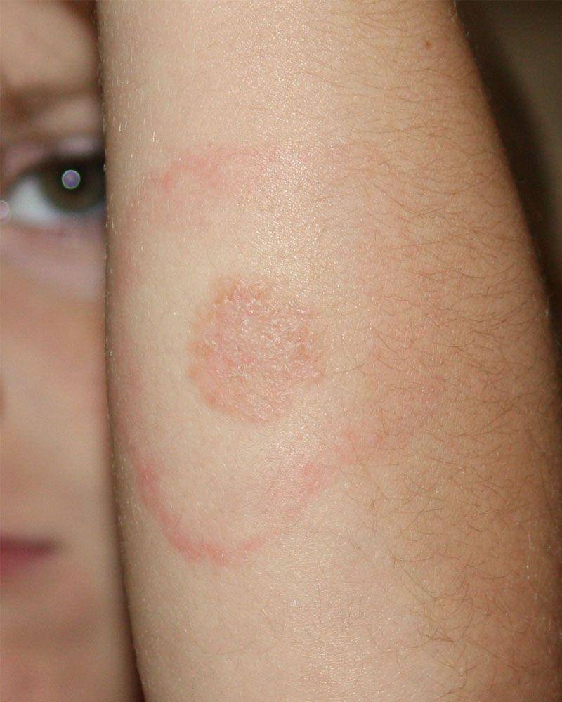 Commons.wikimedia.org