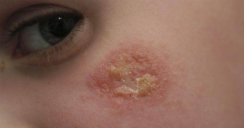 Flikr.com/niels_olson