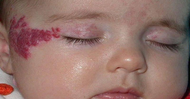 Pinterest/BerylMargie