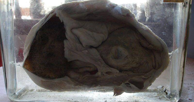 Commons.wikimedia.org