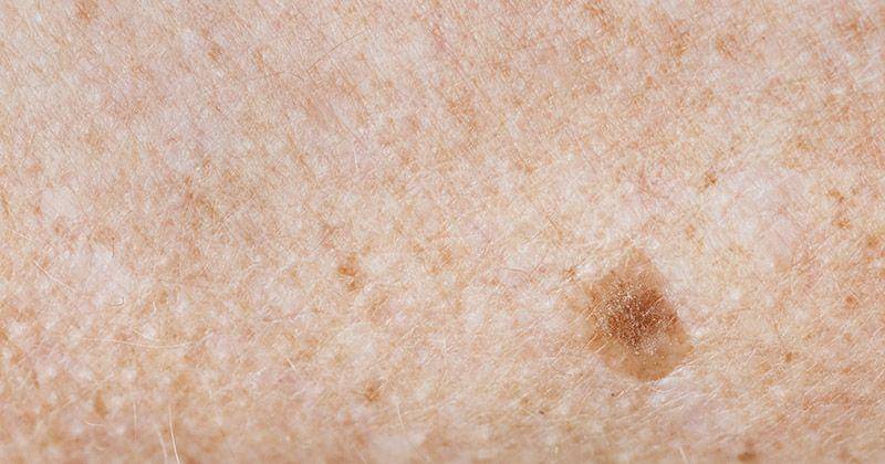 Freepik/Rawpixel.com