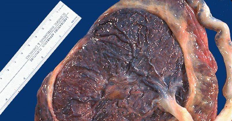 webpath.med.utah.edu