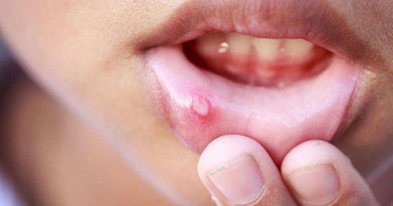 Manfaat kemiri untuk keluarga - pinterest.com/geetika0855