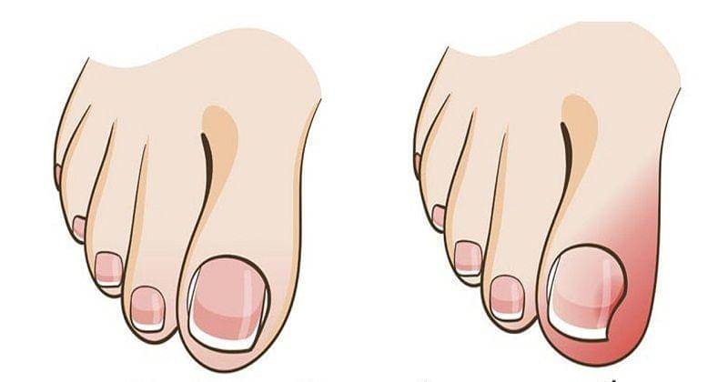 Youtube/Natural Cures