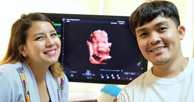 Tinggal Menghitung Hari, Tya Ariestya Kemungkinan Melahirkan Caesar