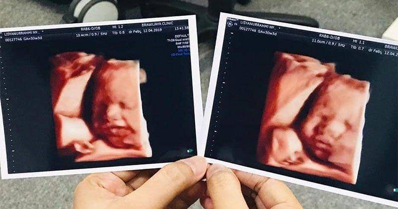 Instagram.com/tommykurniawann