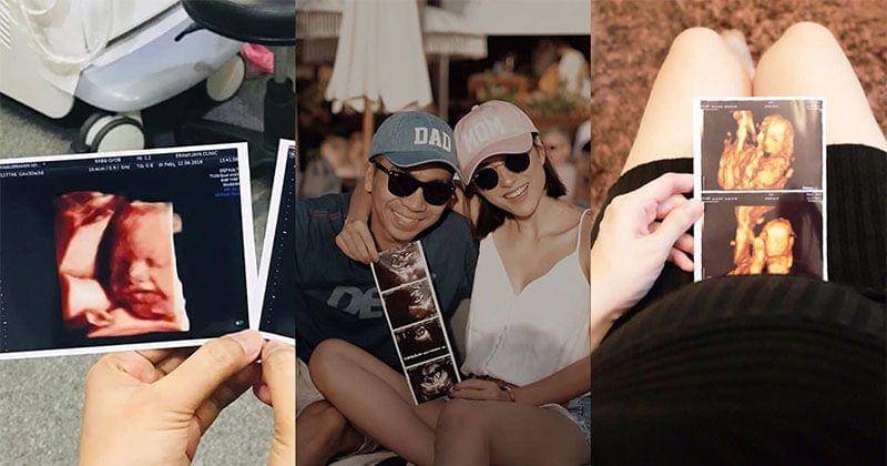 Instagram.com/tommykurniawann/lolitagustine/xxrynisme