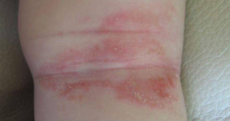 Wikimedia Commons/Mech-Dutch Wikipedia