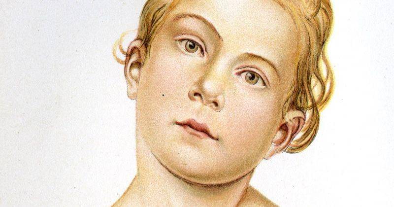 Wikimedia Commons/Ravit