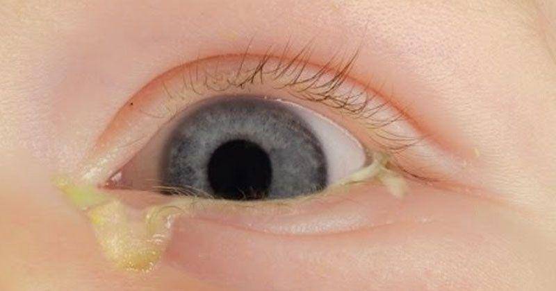 YouTube.com/essential parent