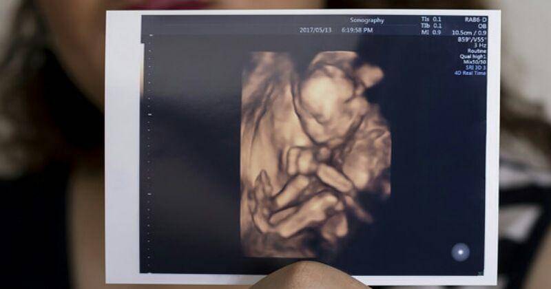 Freepik/bluemoon1981