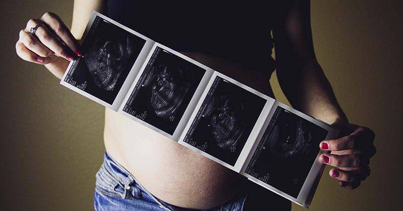 Unsplash/Cassidy Rowell