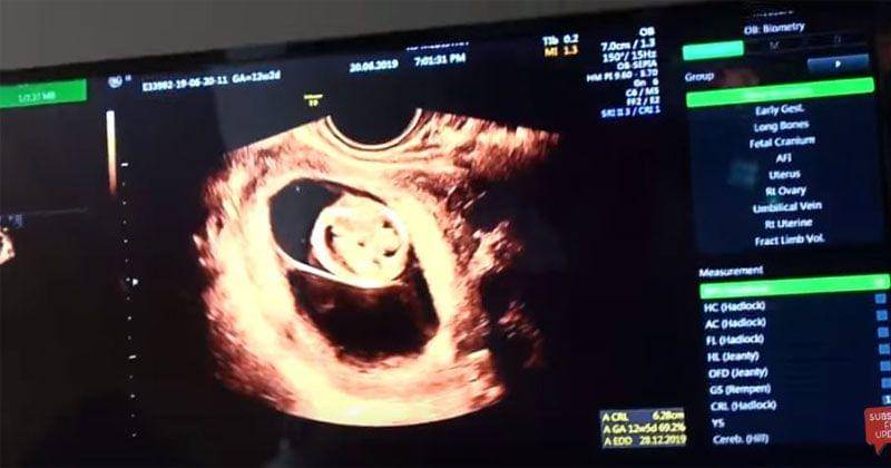 YouTube.com/AishLoveStory