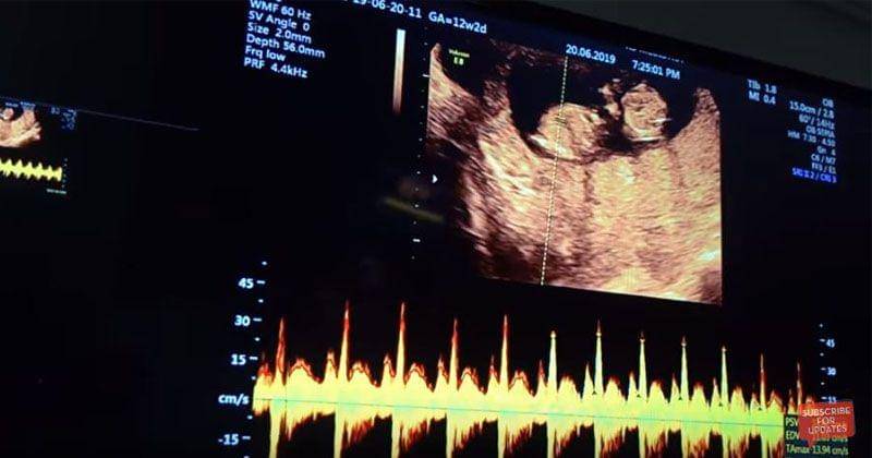 YouTube.com/AishLoveStory