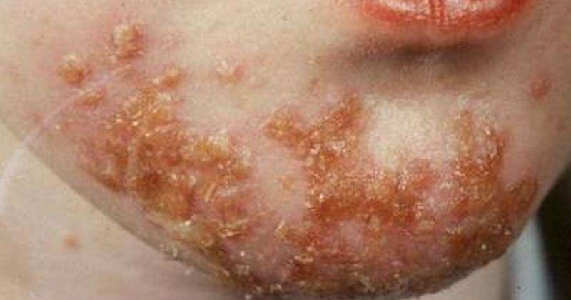 pedclerk.bsd.uchicago.edu