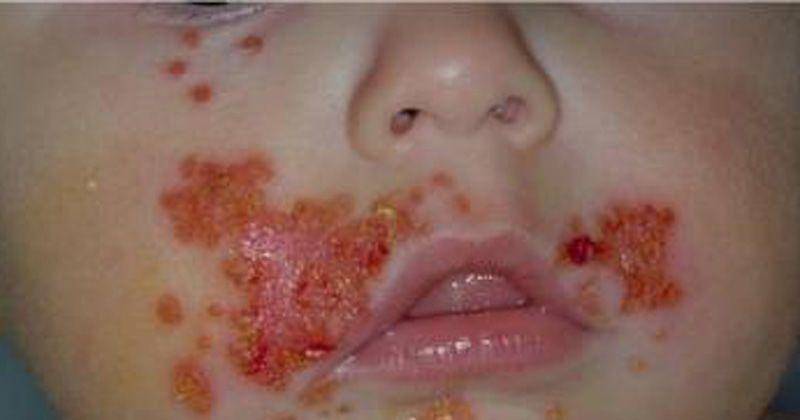 pedclerk.bsd.uchicago.edu