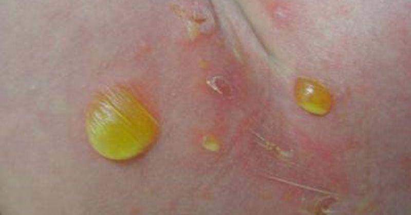 pedclerk.bsd.uchicago.edu