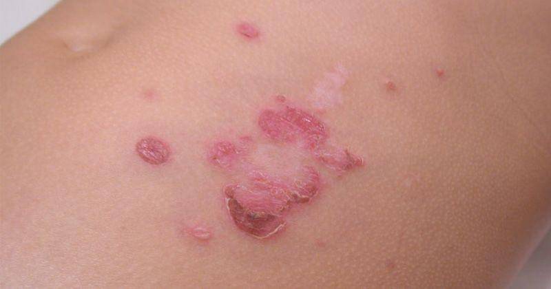 primehealthchannel.com