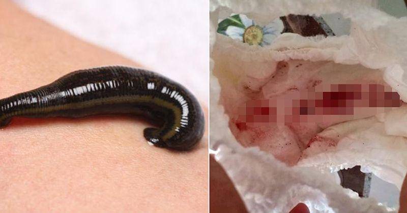 Facebook/Napaporn Thanawong